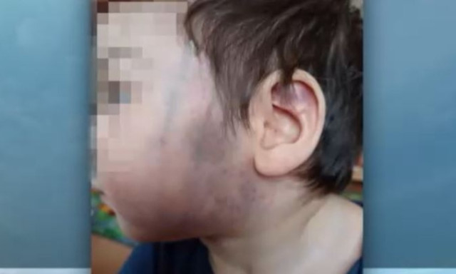 S&uacute;lyosan b&aacute;ntalmazhattak egy m&aacute;sf&eacute;l &eacute;ves kisfi&uacute;t a szeksz&aacute;rdi gyermekotthonban